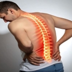 Bel Fıtığı Ameliyatı: Hangi Yöntem Daha Uygun ve Ne Zaman Gerekir?