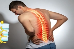 Bel Fıtığı Ameliyatı: Hangi Yöntem Daha Uygun ve Ne Zaman Gerekir?