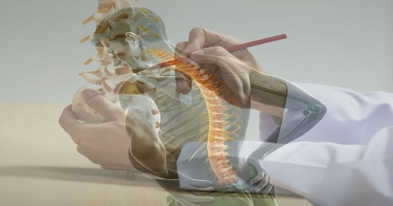 Bel Fıtığında Platin Kullanımı Gerekli mi?