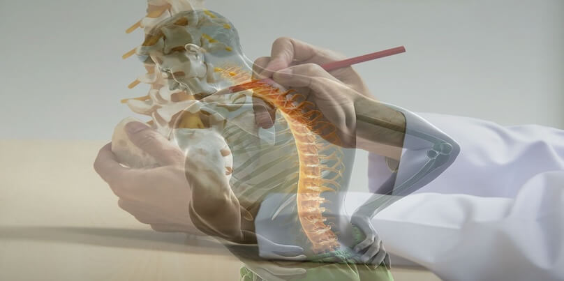 Bel Fıtığında Platin Kullanımı Gerekli mi